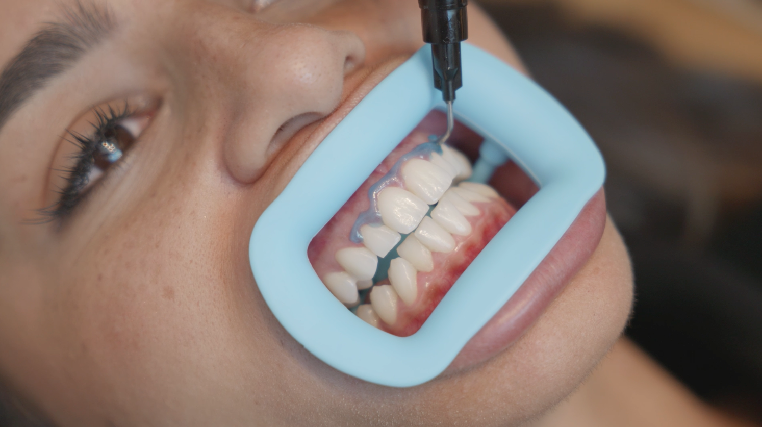 image d'illustration centre